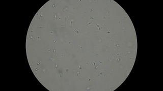 精子在显微镜下的运动视频素材模板下载