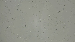 精子在显微镜下的运动视频素材模板下载