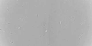 精子在显微镜下的运动