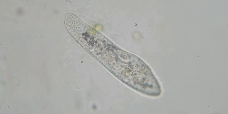 尾草履虫是显微镜下的单细胞纤毛原生动物和细菌属