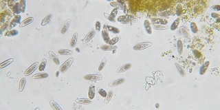 四膜虫是显微镜下的单细胞纤毛原生动物和细菌属
