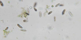 四膜虫是显微镜下的单细胞纤毛原生动物和细菌属