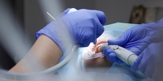 医学研究中，医生在橡胶无菌手套的帮助下用专用牙科器械清洗病人的牙齿