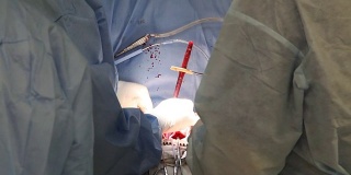 心脏手术。在外科工作。