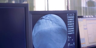 手术实时信息显示在电脑屏幕上。心脏手术的概念。在手术室里，外科医生正在给病人做手术。