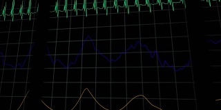 模拟心率医疗机器