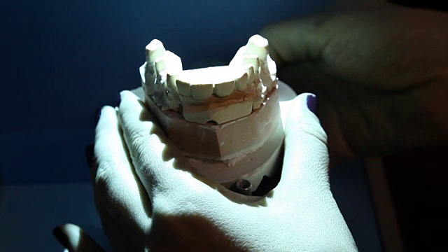 扫描牙齿印模以便在打印机上进一步打印。