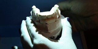 扫描牙齿印模以便在打印机上进一步打印。