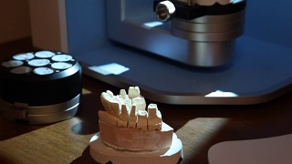 扫描牙齿印模以便在打印机上进一步打印。视频素材模板下载