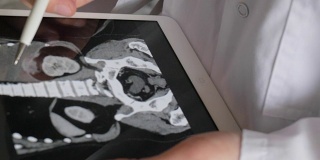医生检查腹腔计算机断层扫描