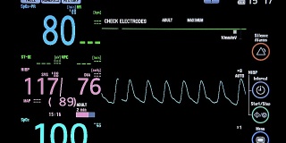 手术室心脏监护仪的关闭。心电监护仪显示患者的心率背景