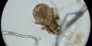 在显微镜下观察，死尘螨成了微生物的栖息地