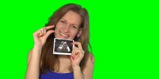 一名孕妇正拿着超声波图看着摄像机微笑着