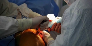 整形外科医生通过房间里的一个大红洞来修复人类的臀部关节
