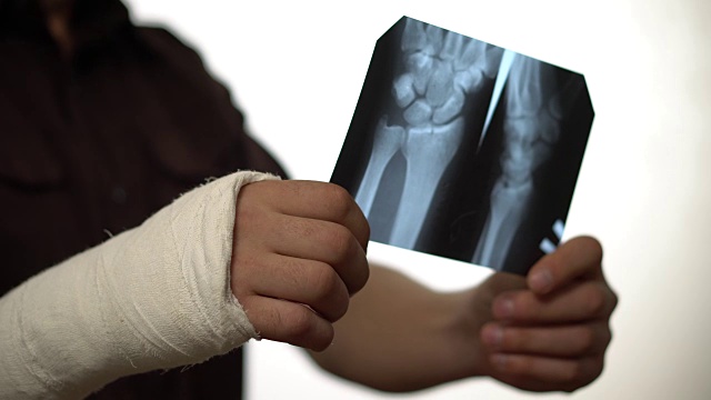 一名右手骨折的男子看着仁根的照片。手骨折导致残疾。健康保险。特写镜头