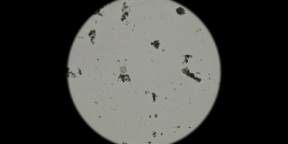 微生物在显微镜下作为外来生物存在于水库中的微生物