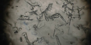 显微镜下的冰晶