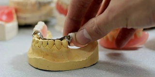 在牙科实验室里，医生根据颌骨模型检查假牙