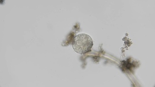 显微镜下微生物的幼虫，胚胎视频素材模板下载