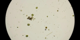 藻类秀丽隐杆线虫的显微镜下