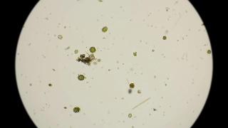 藻类秀丽隐杆线虫的显微镜下视频素材模板下载