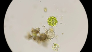 藻类秀丽隐杆线虫的显微镜下视频素材模板下载