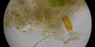 在显微镜下观察硅藻和微生物