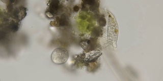 在显微镜下，鞋上的滴虫通过指状纤毛进食