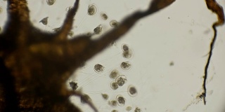 显微镜下的一群吸盘微生物