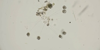 显微镜下的一群吸盘微生物