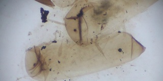 光显微镜下的库蚊卵