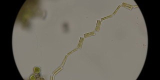 硅藻在显微镜下相互连接