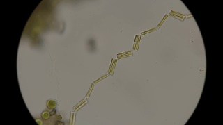 硅藻在显微镜下相互连接视频素材模板下载