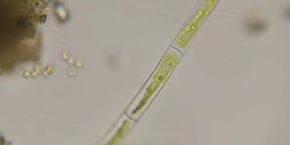 显微镜下的丝状藻类