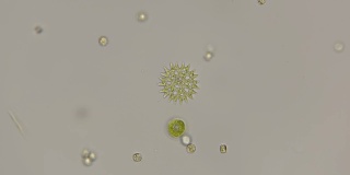 显微镜下美丽的硅藻图案