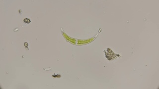 硅藻Klosterium显微镜下视频素材模板下载