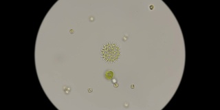 显微镜下美丽的硅藻图案