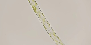 显微镜下的丝状藻类螺旋藻