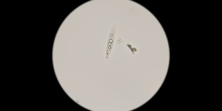 在显微镜下观察淡水中的硅藻