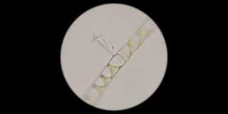 显微镜下的丝状藻类螺旋藻