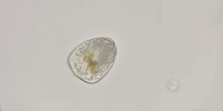 最简单的微生物在显微镜下以两种硅藻为食
