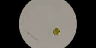 显微镜下单细胞藻类的运动