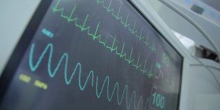 心电监护仪的数据