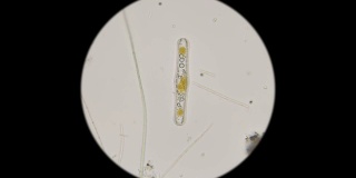 在显微镜下观察淡水中的硅藻