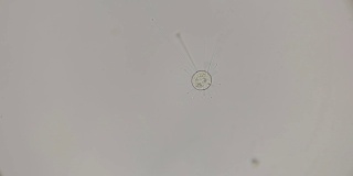 微孢子虫在显微镜下观察