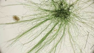活藻类在显微镜下运动，类似于身体的触须，这很令人兴奋视频素材模板下载