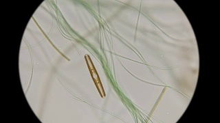 显微镜下硅藻在普通活藻类中的运动视频素材模板下载