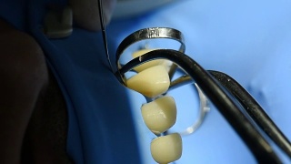牙科柜中牙齿的近景。视频素材模板下载