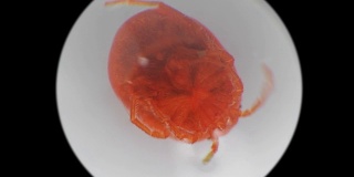 显微镜下的水螨水螅虫