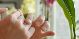 应用润滑剂霜防晒到损坏的手指皮肤特写